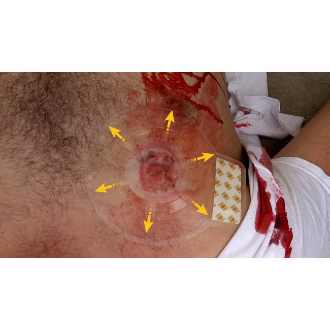 H*Vent Chest Seal Twinpack aresmaxima.com